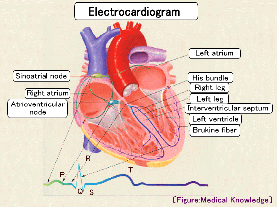 electrocardiogram:delta wave